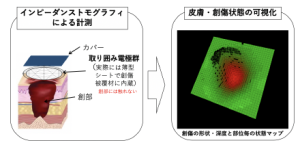 impedance tomography